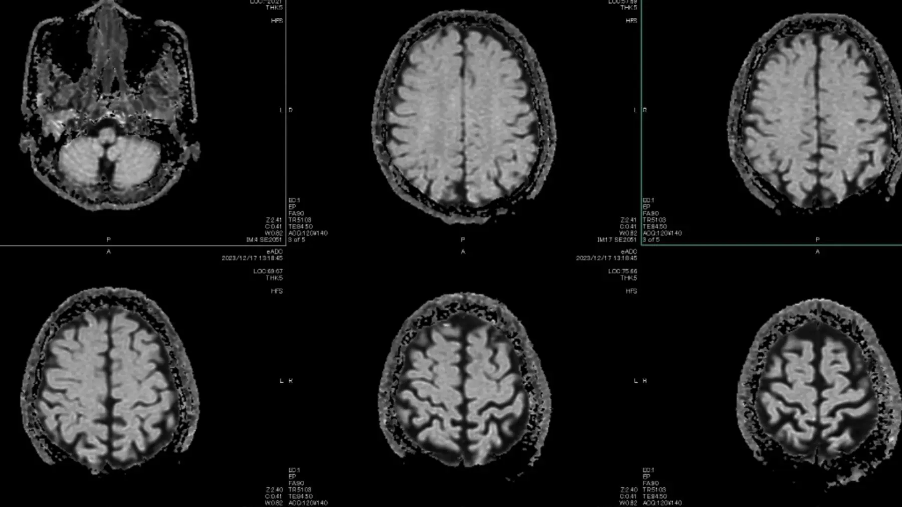 Healthcare Is AI’s Hardest Test